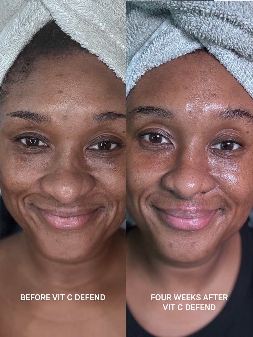 Split before and after photograph of a woman&rsquo;s face, captioned BEFORE VIT C DEFEND and FOUR WEEKS AFTER VIT C DEFEND. The after half shows a brighter complexion with dark spots less pronounced.