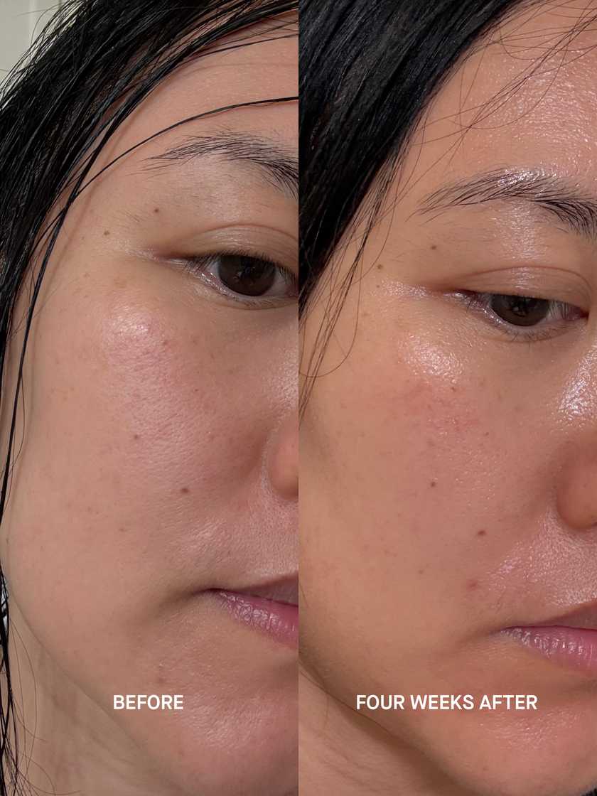 Before and after close-up of a woman&rsquo;s cheek at a three-quarter angle: visible texture and duller tone before, smoother and brighter after four weeks of using the Tri Lipid Replenish Treatment.
