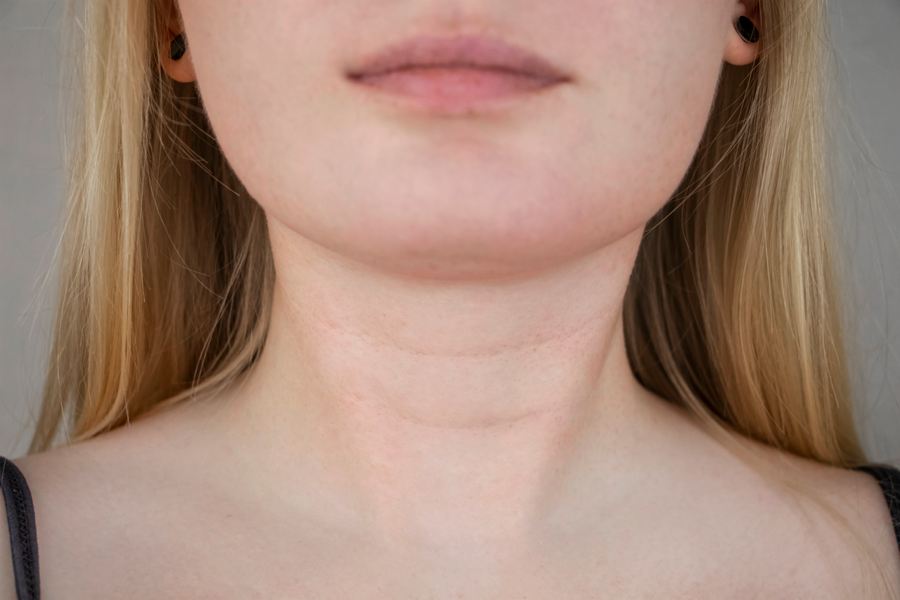 Close-up of a woman&rsquo;s lower face, neck and upper chest against a plain grey studio background, with horizontal creases running across the neck.